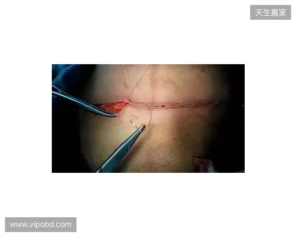 广州豹官方:杨浩眉弓伤口缝合30余针,预计5-7天后拆线 广州豹官方:杨浩眉弓伤口缝合30余针,预计5-7天后拆线